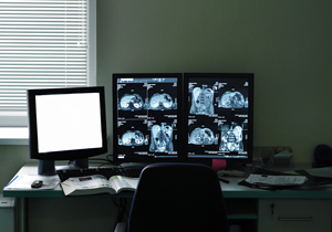 Picture of monitor with MRI scans across of it.
